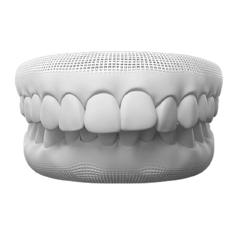 Overbite